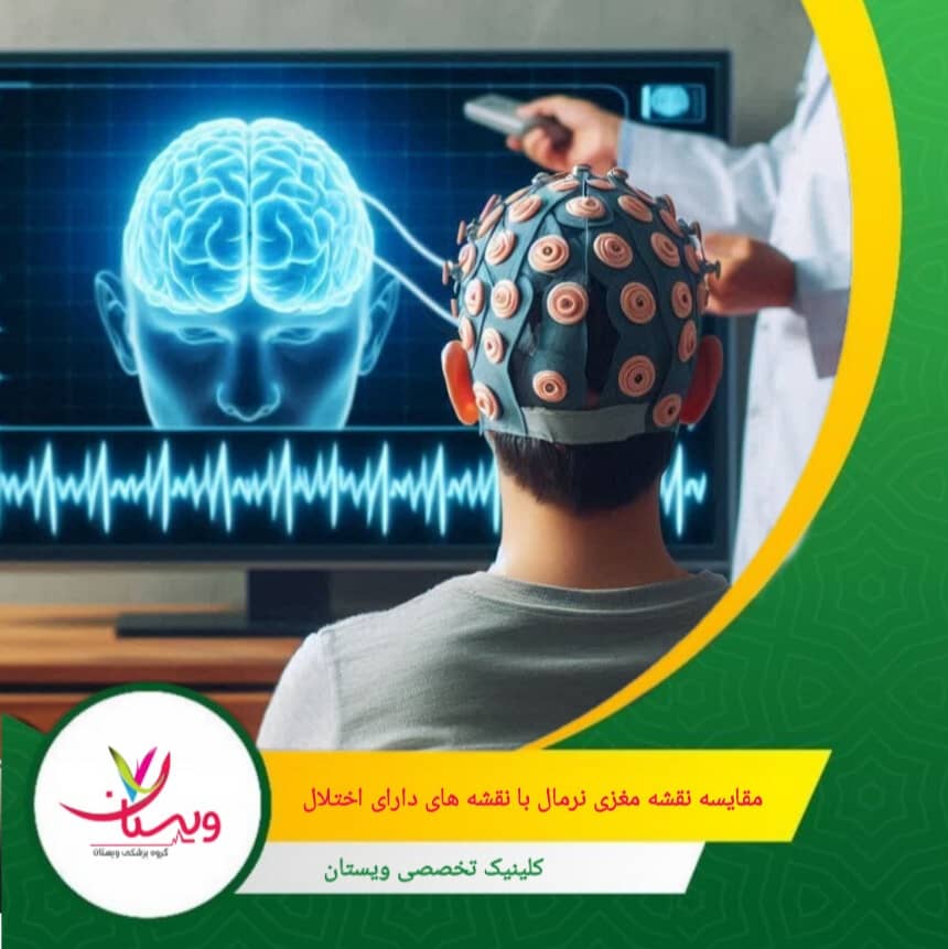 در صرع یا اختلالات خاص، نواحی خاصی فعالیت غیرطبیعی دارند که به شکل نقاط قرمز یا بنفش ظاهر میشوند. مقایسه نقشه مغزی نرمال با نقشههای دارای اختلال