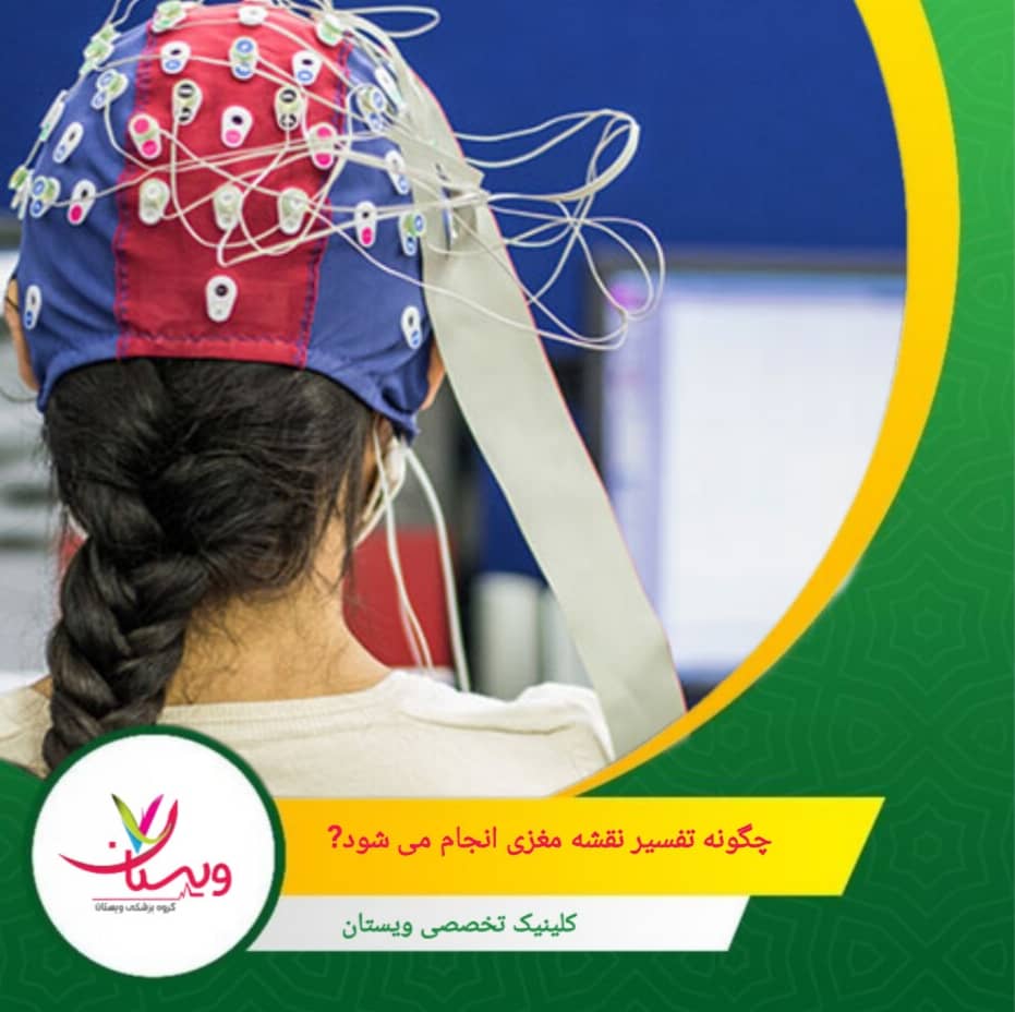 چگونه تفسیر نقشه مغزی انجام میشود؟