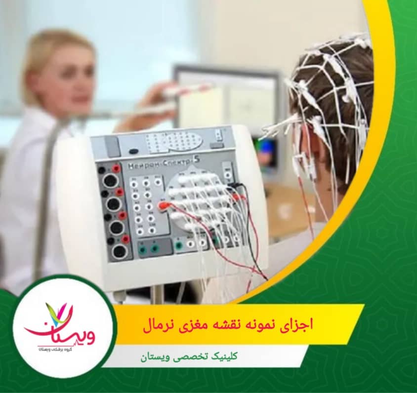 فعالیت مغزی باید بین نیمکره راست و چپ تقریباً متعادل باشد. در حالت نرمال اختلاف زیادی دیده نمیشود. اجزای نمونه نقشه مغزی نرمال