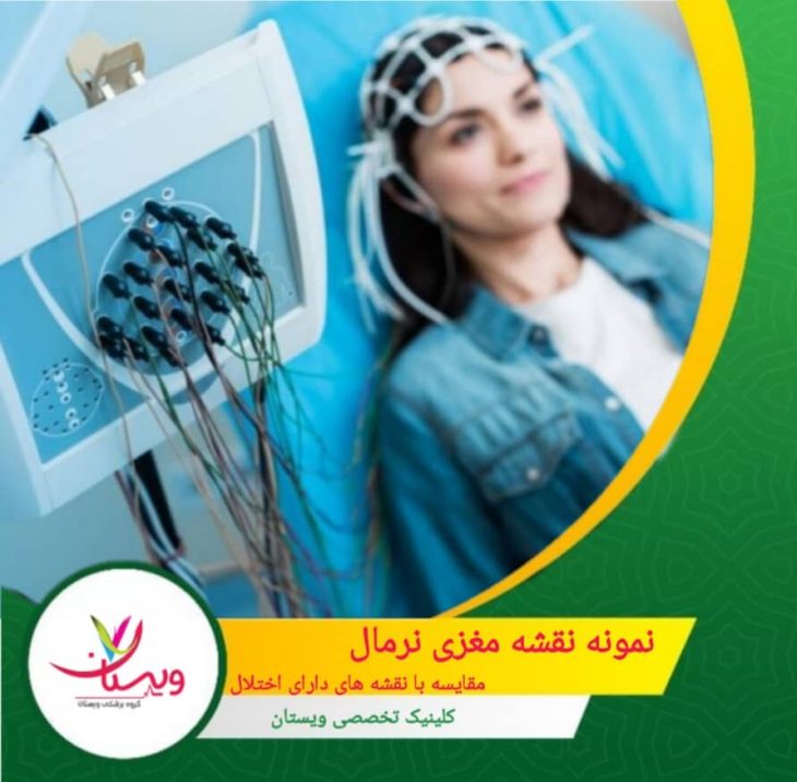 نمونه نقشه مغزی نرمال: مقایسه با نقشههای دارای اختلال