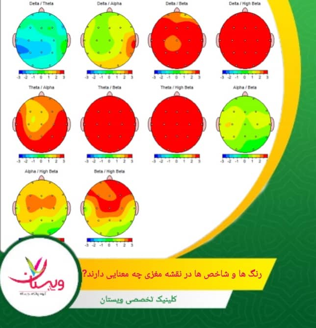 نسبت بین باندهای فرکانسی مختلف، مانند نسبت بتا به تتا، که میتواند نشاندهنده وضعیتهای مختلف ذهنی باشد. رنگها و شاخصها در نقشه مغزی چه معنایی دارند؟