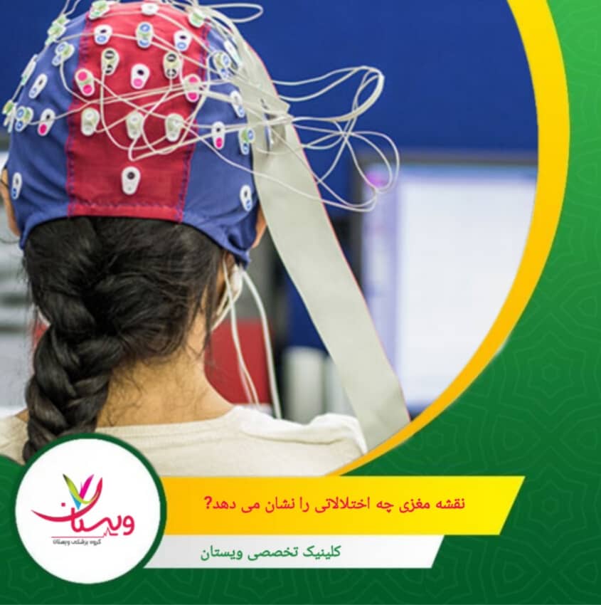 نقشهمغزی کمی یا QEEG ابزاری است که با ثبت و تحلیل دقیق امواج مغزی میتواند به شناسایی بسیاری از اختلالات عصبی و روانپزشکی کمک کند؛ اختلالاتی که گاهی در EEG ساده دیده نمیشوند. نقشه مغزی چه اختلالاتی را نشان میدهد؟