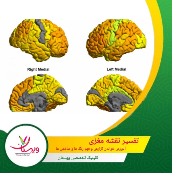 تفسیر نقشه مغزی: آموزش خواندن گزارش و فهم رنگها و شاخصها