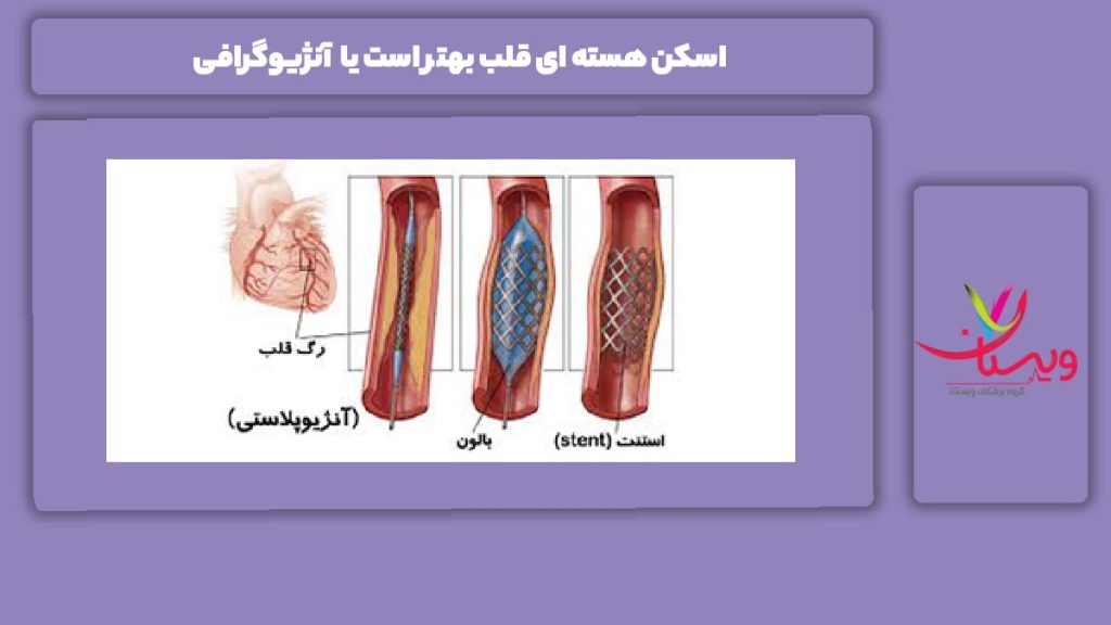 فرق بین اسکن هسته ای و آنژیوگرافی اسکن هسته ای قلب بهتر است یا آنژیوگرافی