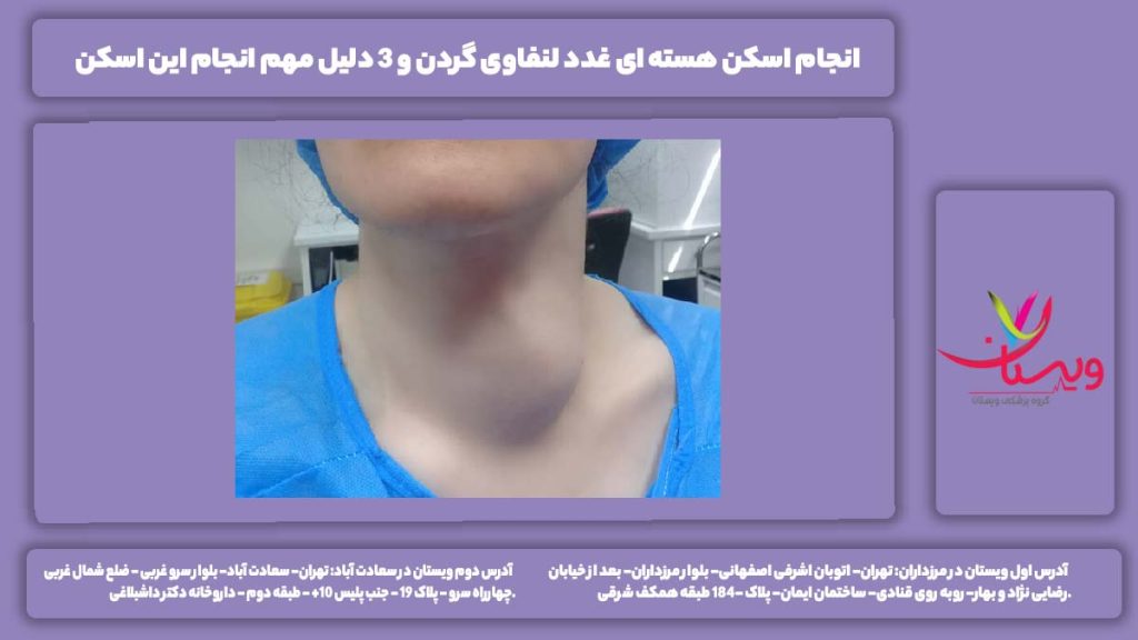 اسکن هسته ای غدد لنفاوی