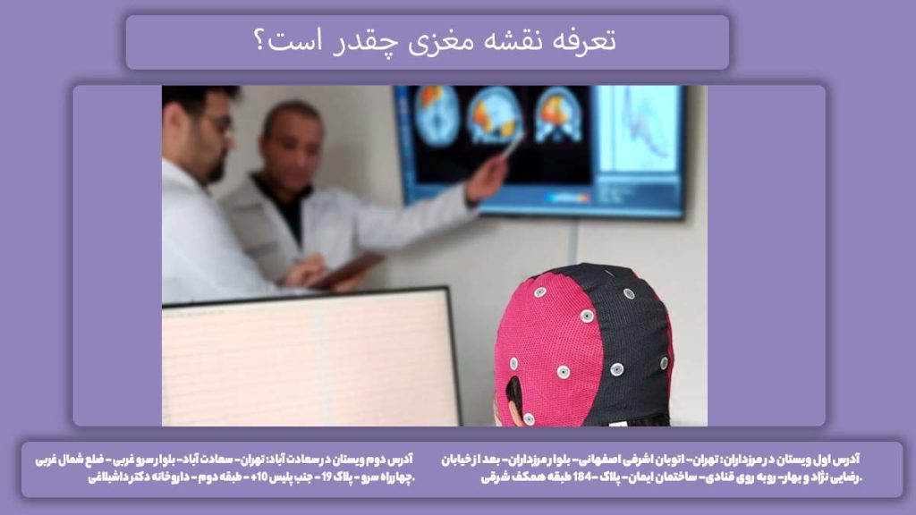 نرخ نقشه مغزی تعرفه نقشه مغزی چقدر است؟