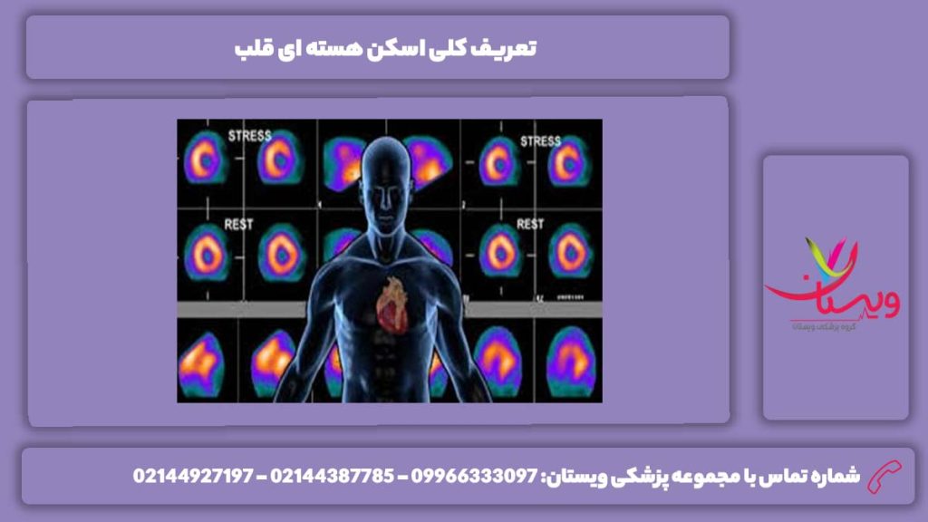 چیستی اسکن هسته ای قلب تعریف کلی اسکن هسته ای قلب