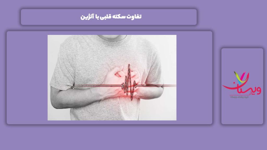 فرق میان سکته قلبی با آنژین قلبی تفاوت سکته قلبی با آنژین
