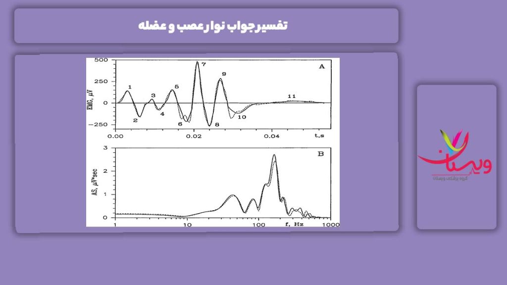 شرح جواب نوار عصب و عضله تفسیر جواب نوار عصب و عضله