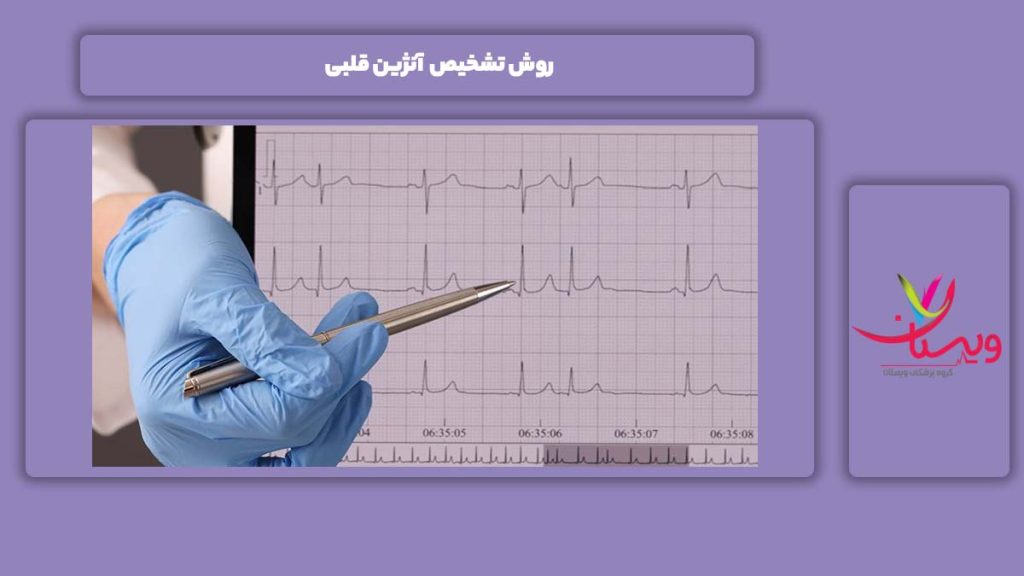 راه تشخیص آنژین قلبی روش تشخیص آنژین قلبی