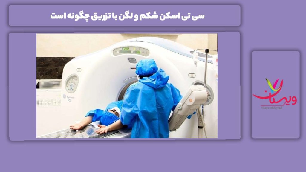چگونگی سی تی اسکن شکم و لگن با تزریق سی تی اسکن شکم و لگن با تزریق چگونه است