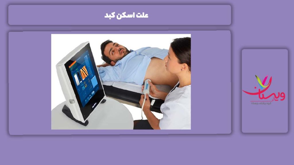 دلیل انجام دادن اسکن کبد علت اسکن کبد