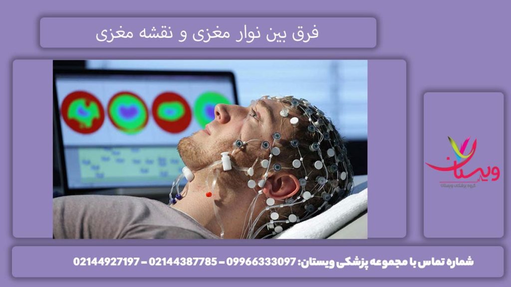تفاوت نوار مغزی و نقشه مغزی را بدانید