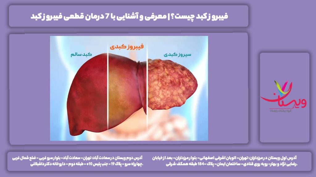 فیبروز کبد چیست؟