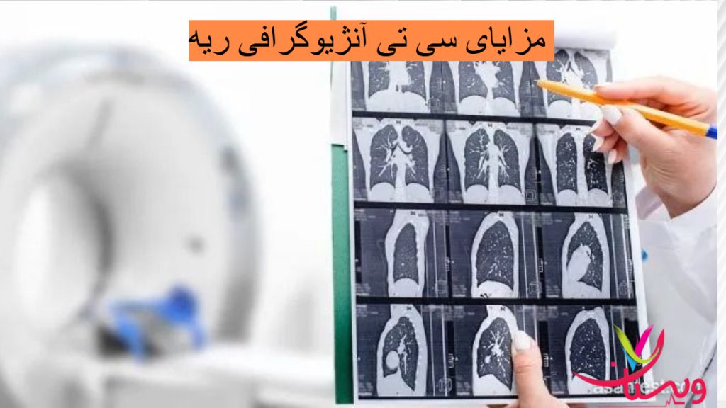 بررسی سی تی آنژیوگرافی ریه بررسی سی تی آنژیوگرافی ریه