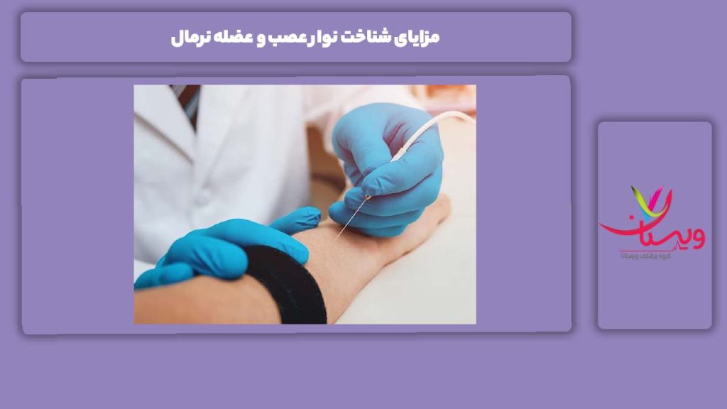 ویژگیهای شناخت نوار عصب و عضله نرمال مزایای شناخت نوار عصب و عضله نرمال
