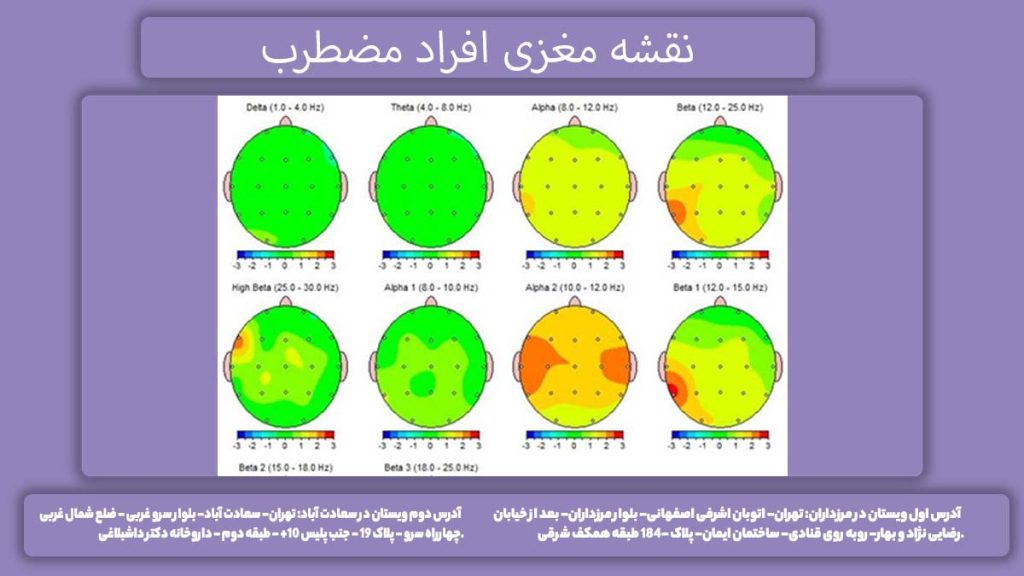 مغز دچار اضطراب نقشه مغزی افراد مضطرب