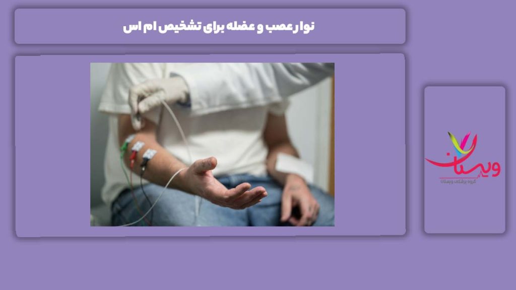 تشخیص ام اس با نوار عصب و عضله نوار عصب و عضله برای تشخیص ام اس