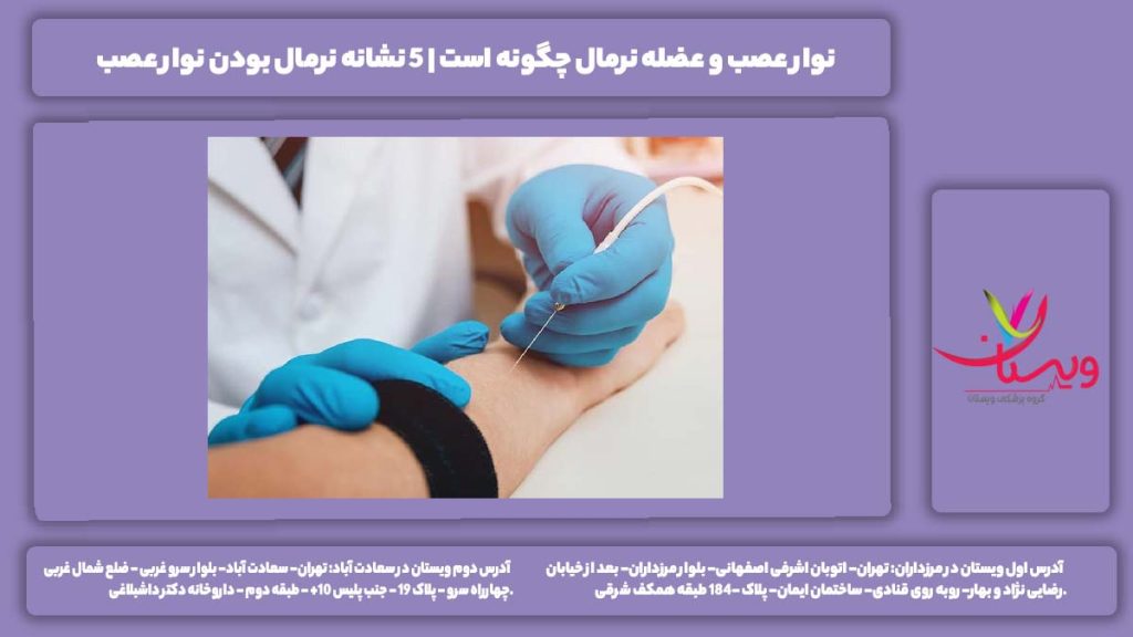 نوار عصب و عضله نرمال