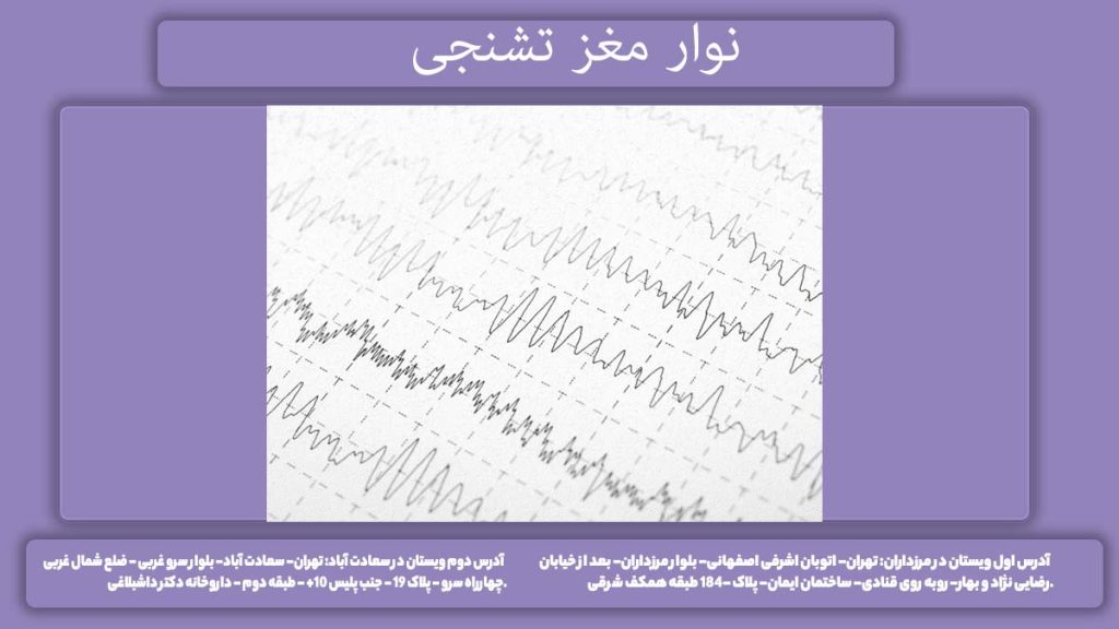 عکس نوار مغر فرد دچار تشنج نوار مغز تشنجی