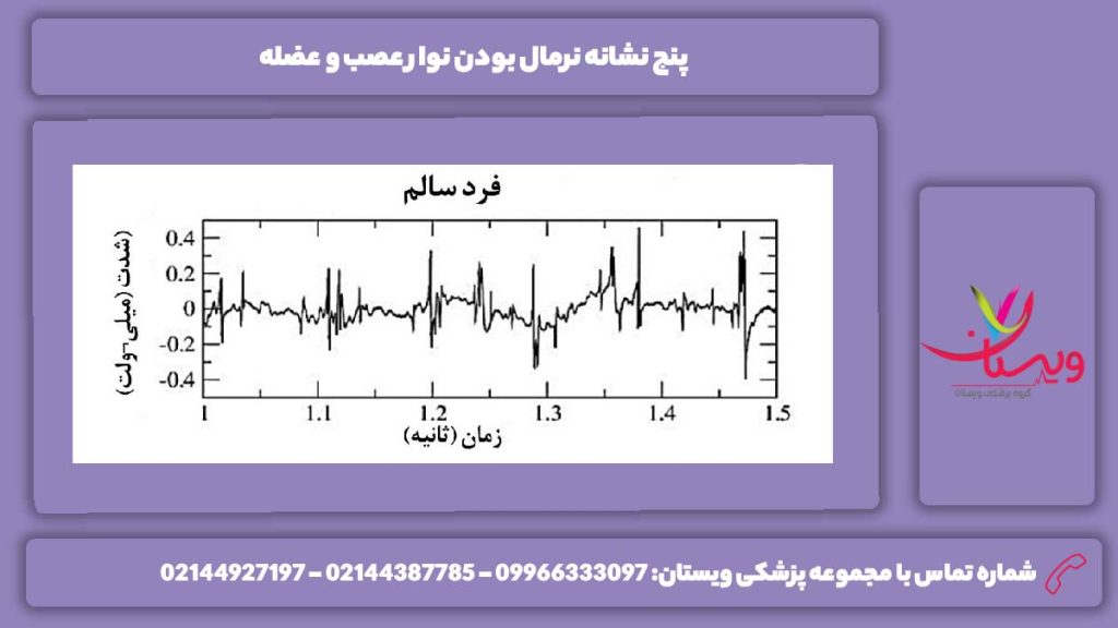 ویژگیهای نوار عصب و عضله نوار عصب و عضله نرمال