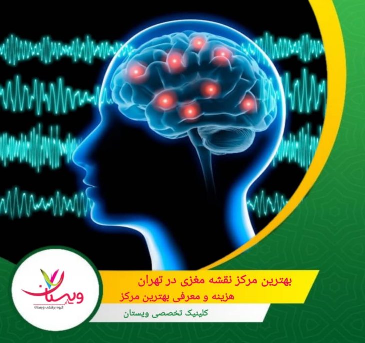 بهترین مرکز نقشه مغزی در تهران | هزینه و معرفی بهترین مرکز