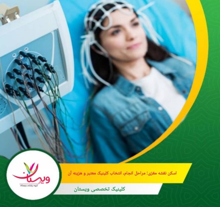 اسکن نقشه مغزی: مراحل انجام، انتخاب کلینیک معتبر و هزینه آن