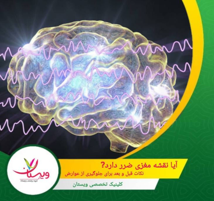 آیا نقشه مغزی ضرر دارد؟ نکات قبل و بعد برای جلوگیری از عوارض