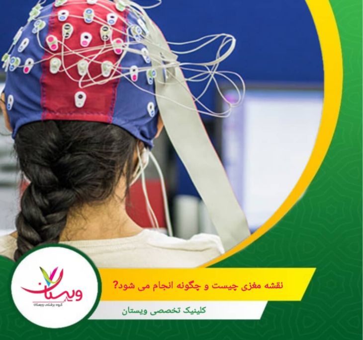 فرایند انجام نقشهمغزی کاملاً غیرتهاجمی، بدون درد و ایمن است. در طول انجام آن، هیچ اشعه، تزریق یا شوکی به مغز وارد نمیشود. نقشه مغزی چیست و چگونه انجام میشود؟