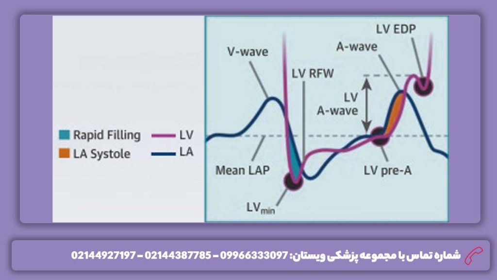 عمکلرد بطن چپ درمان اختلال عملکرد دیاستولیک خفیف بطن چپ
