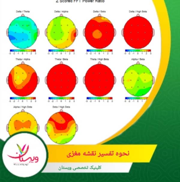 با انجام نقشهمغزی در فواصل زمانی مشخص، میتوان تغییرات عملکرد مغز را دنبال کرد و اثر درمانها را ارزیابی کرد. نحوه تفسیر نقشه مغزی