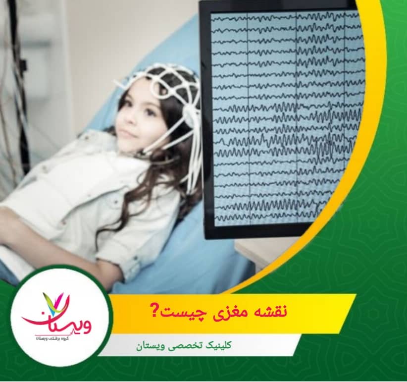 نقشهمغزی مانند گرفتن عکسی از عملکرد مغز است؛ اما به جای ساختار مغز، تمرکز روی الگوها و عملکرد مغزی است. نقشه مغزی چیست؟