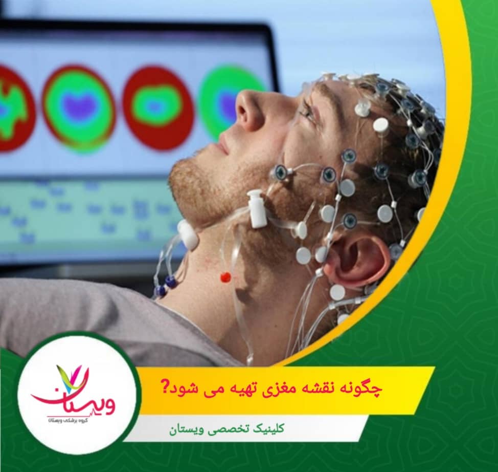 در طول جلسه، فرد در حالت آرام و نشسته قرار میگیرد. در ابتدا، فعالیت مغزی در حالی که چشمها باز هستند ضبط میشود. چگونه نقشه مغزی تهیه میشود؟