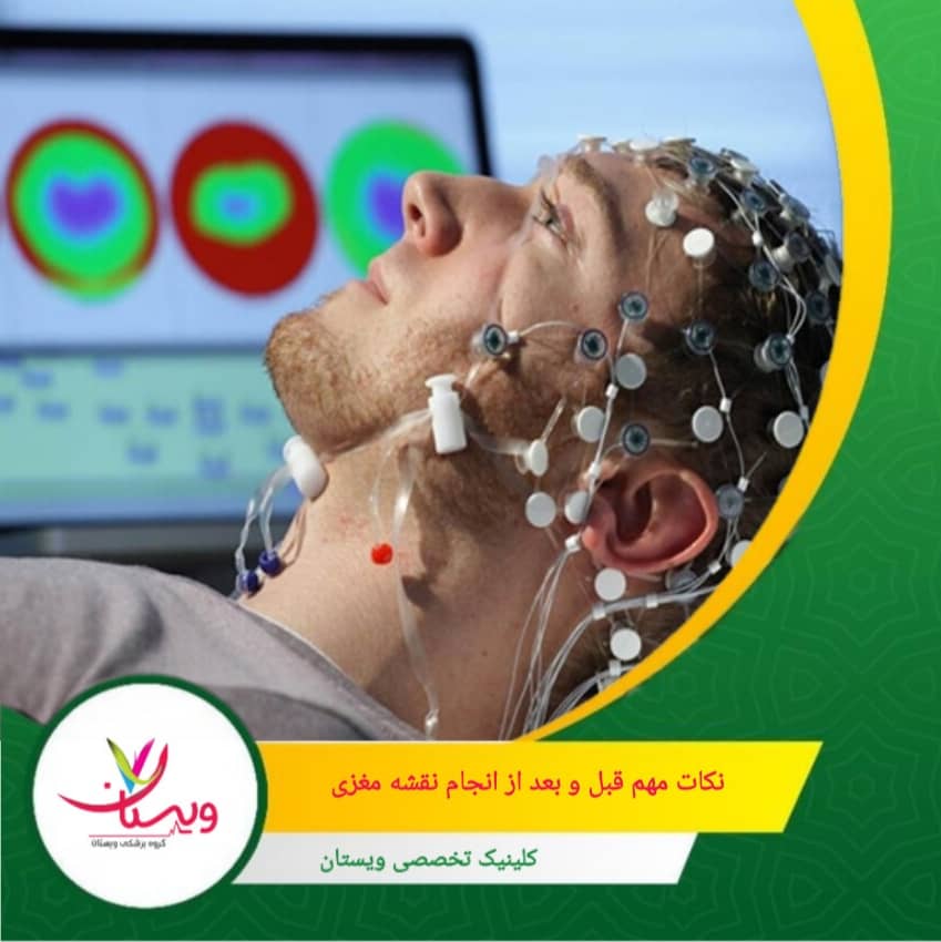 پس از تست میتوانید فعالیتهای روزانه خود را ادامه دهید مگر پزشک توصیه خاصی داشته باشد. نکات مهم قبل و بعد از انجام نقشه مغزی