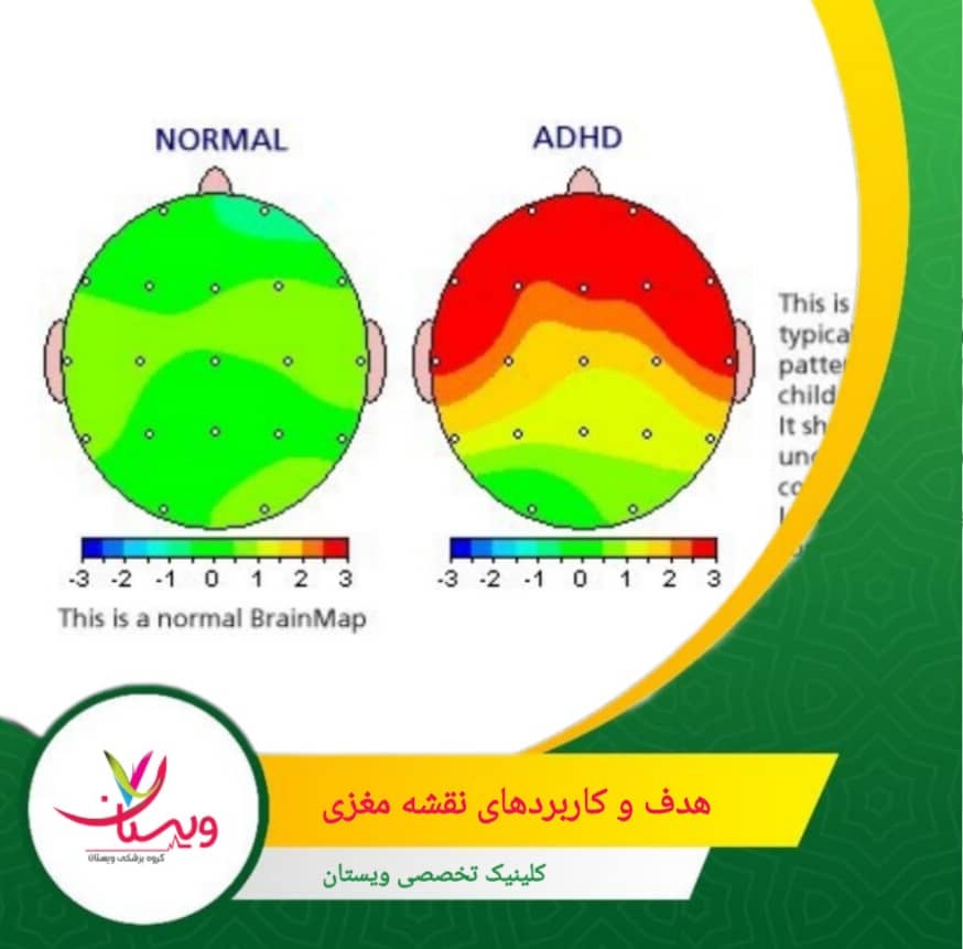 یکی از مهمترین کاربردهای نقشه مغزی، کمک به تشخیص دقیقتر اختلالاتی مانند افسردگی، اضطراب، بیشفعالی (ADHD)، صرع، مشکلات خواب و آسیبهای مغزی است. هدف و کاربردهای نقشه مغزی