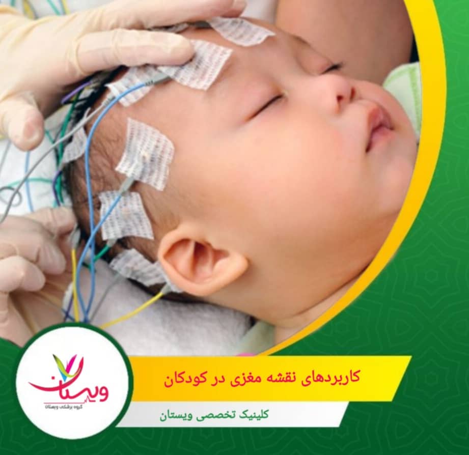 تحلیل الگوهای فعالیت مغزی برای بهبود درمانهای نوروفیدبک و توانبخشی شناختی. کاربردهای نقشه مغزی در کودکان