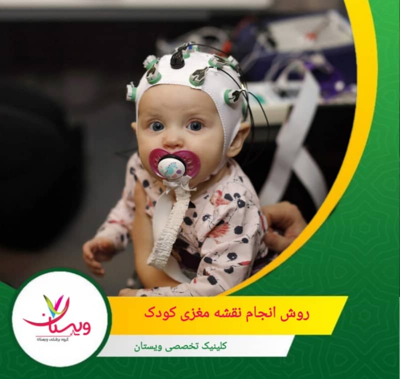 فعالیت مغزی کودک در حالتهای مختلف (چشمان باز و بسته) ضبط میشود. روش انجام نقشه مغزی کودک