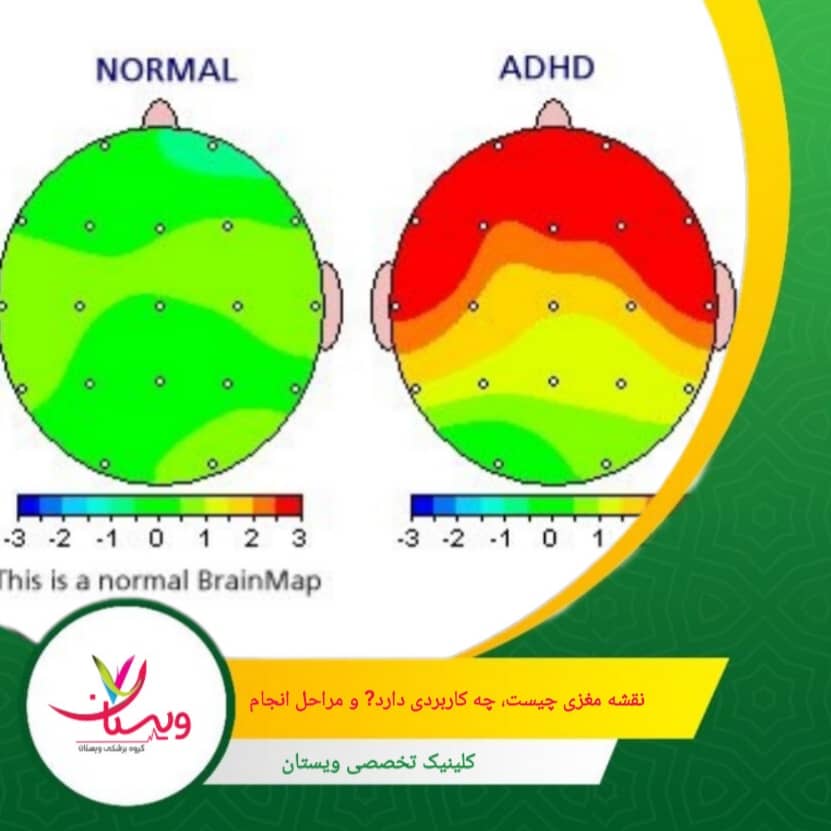 نتایج به صورت نقشههای مغزی و گزارشهای تحلیلی به فرد یا پزشک ارائه میشود تا در طراحی برنامه درمانی یا ارزیابی وضعیت مغزی استفاده گردد. نقشه مغزی چیست، چه کاربردی دارد؟ و مراحل انجام