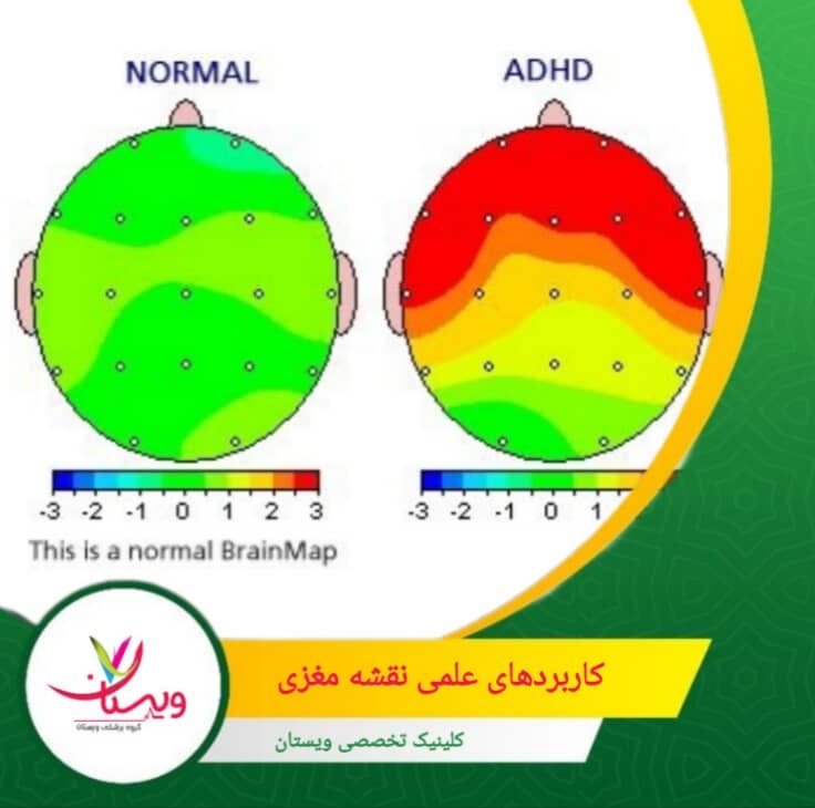 تحلیل تمرکز، حافظه و کارکرد ذهنی در گروههای سنی مختلف یا در شرایط محیطی متفاوت. کاربردهای علمی نقشه مغزی