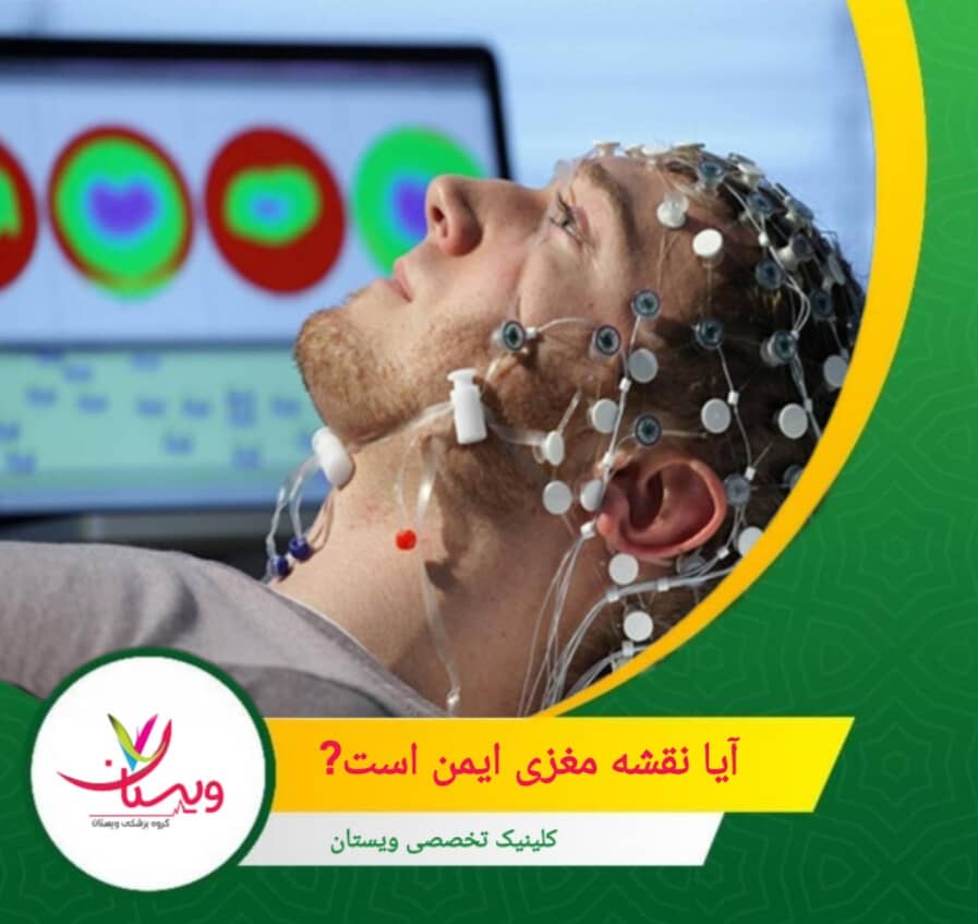 انجام این تست در مراکز معتبر با تکنسین و متخصص مجرب، نه تنها ایمن است، بلکه به ارائه نتایج علمی قابل اعتماد کمک میکند. آیا نقشه مغزی ایمن است؟