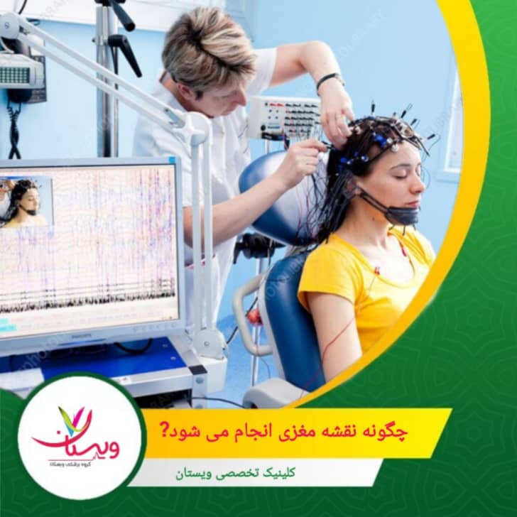 چگونه نقشه مغزی انجام میشود؟