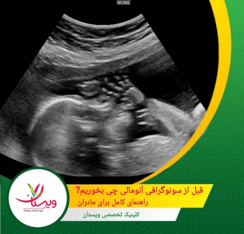 قبل از سونوگرافی آنومالی چی بخوریم؟ راهنمای کامل برای مادران