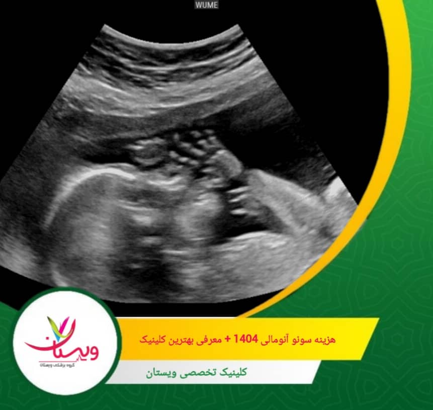 با توجه به تجهیزات پیشرفته و تیم حرفهای، کلینیک ویستان به عنوان بهترین کلینیک برای سونوگرافی آنومالی شناخته میشود. هزینه سونو آنومالی ۱۴۰۴ + معرفی بهترین کلینیک