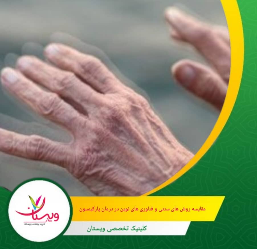 نیاز به مصرف مکرر، نوسان اثر دارو از محدودیت های روش های سنتی درمان پارکینسون می باشد. مقایسه روشهای سنتی و فناوریهای نوین در درمان پارکینسون