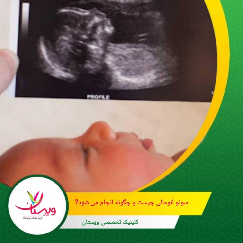 این سونوگرافی بدون درد و بیخطر بوده و حدود ۳۰ تا ۴۰ دقیقه زمان میبرد. سونو آنومالی چیست و چگونه انجام می شود؟