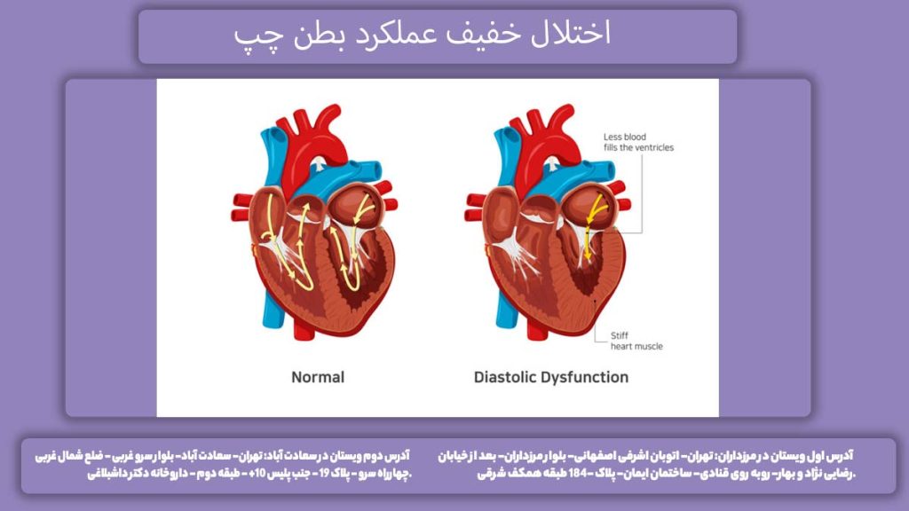 اختلال پرشدگی بطن چپ اختلال عملکرد دیاستولیک بطن چپ