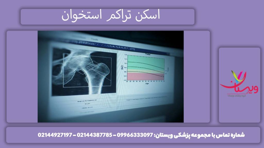 اسکن هسته ای تراکم استخوان چیست؟