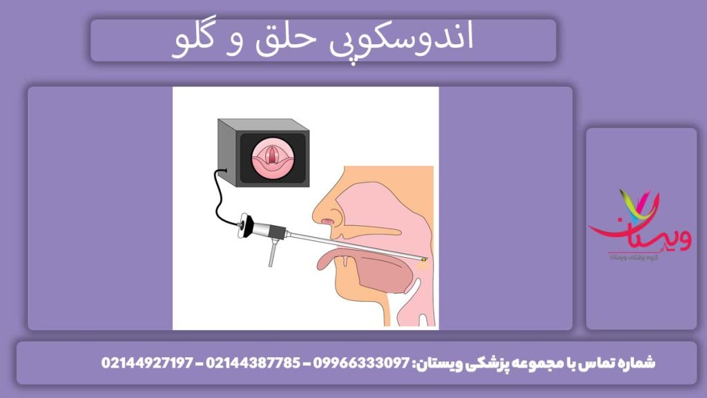 تصویربرداری حلق و حنجره اندوسکوپی حلق و گلو چگونه است؟