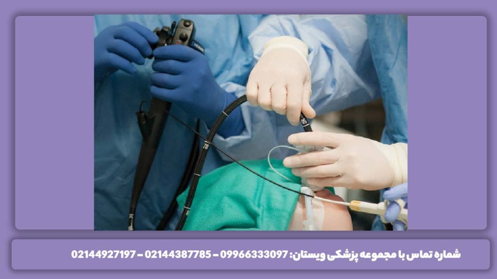 تغذیه مناسب بعد از اندوسکوپی معده عوارض آندوسکوپی کیسه صفرا و تغذیه بعد از آن