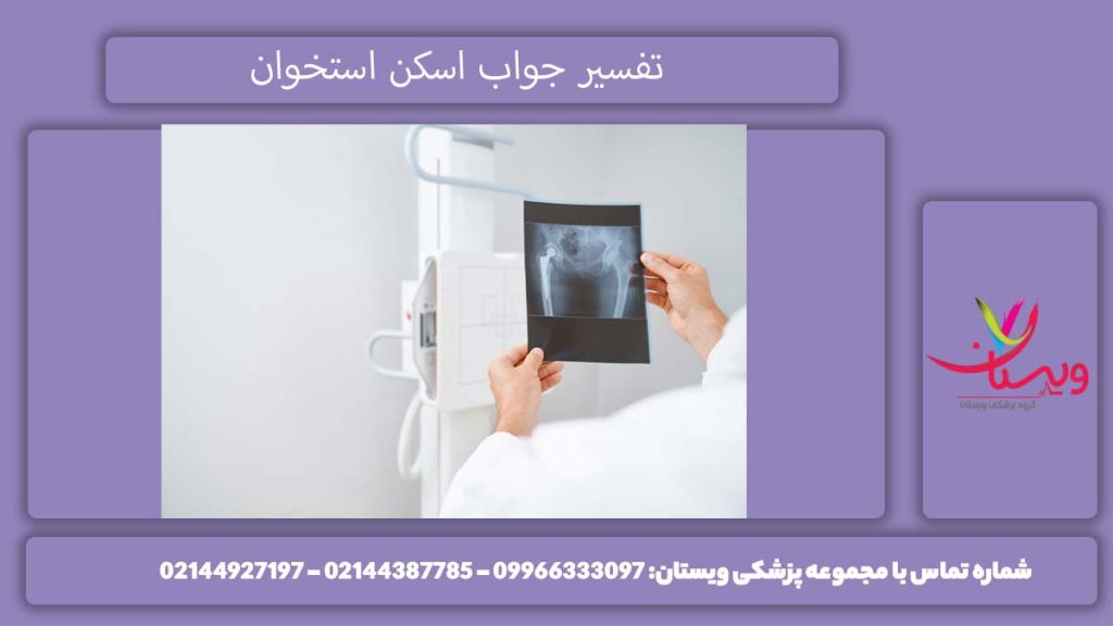 تحلیل آزمایش تراکم استخوان تفسیر اسکن هسته ای تراکم استخوان